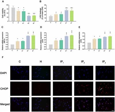 1% Isoflurane and 1.2 μg/ml of Propofol: A Combination of Anesthetics That Causes the Least Damage to Hypoxic Neurons